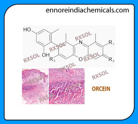 ORCEIN